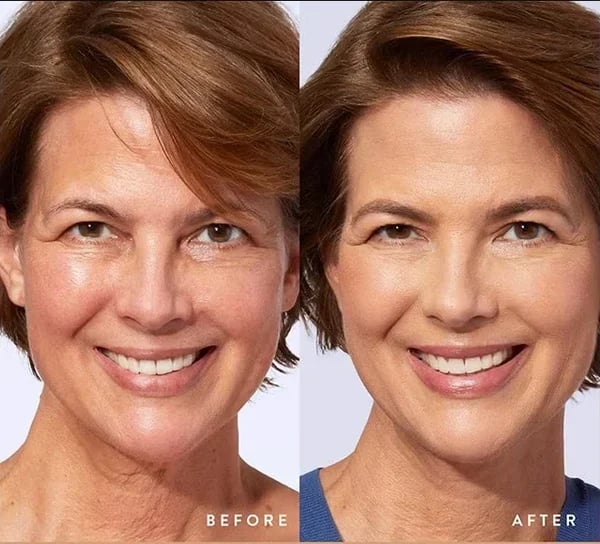 🔥2026 Hot Sale 50% OFF✨⚡ 50K+ SOLD! 🎁4-in-1 Perfecting Foundation – High Coverage, SPF & All-Day Hydration 🤍✨ - Image 6
