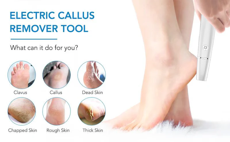 🔥BUY 2 GET 1 FREE💥-🎁Portable Electric Feet Callus Remover - Image 13