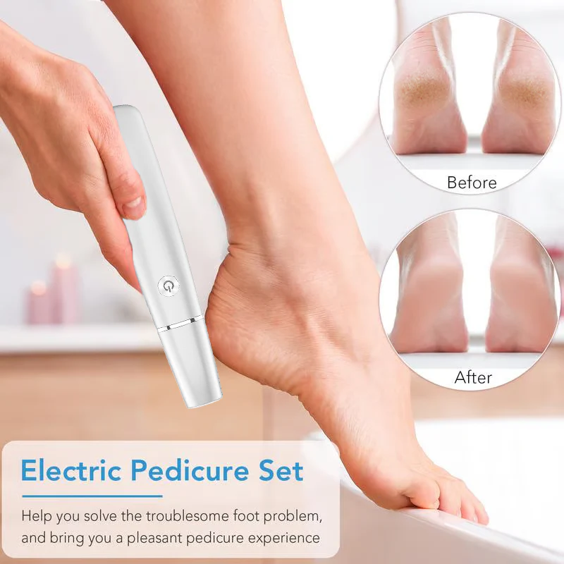 🔥BUY 2 GET 1 FREE💥-🎁Portable Electric Feet Callus Remover - Image 3