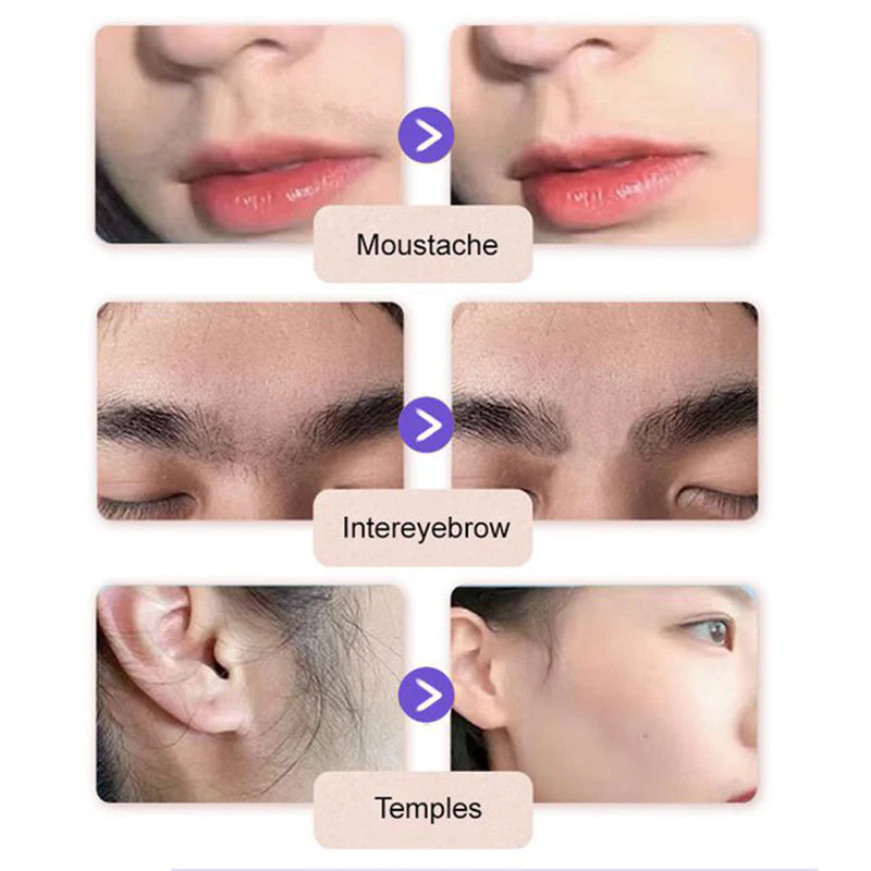 Gentle & Painless Facial Hair Removal Cream - Image 6