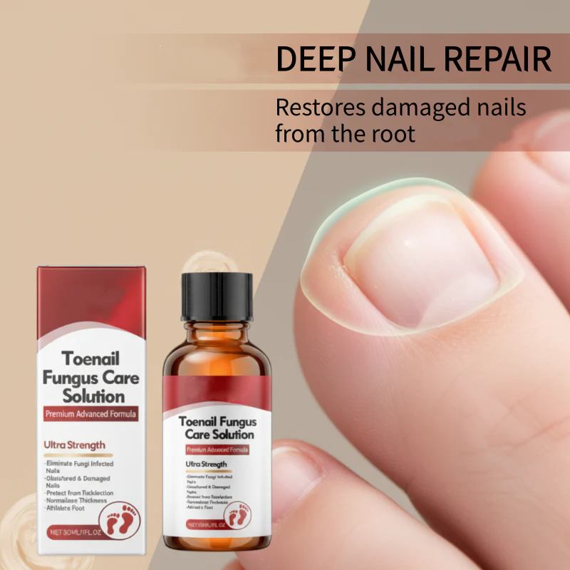 🖤See Real Results Faster🖤Nail Repair Essence for Damaged Nails💅🏻 - Image 10