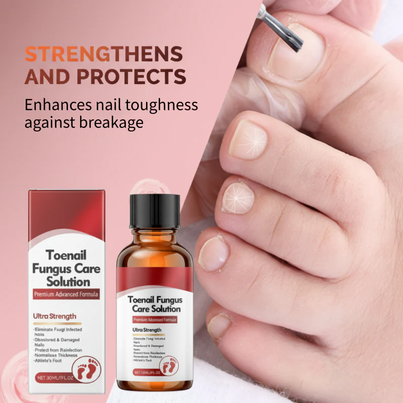 🖤See Real Results Faster🖤Nail Repair Essence for Damaged Nails💅🏻 - Image 5