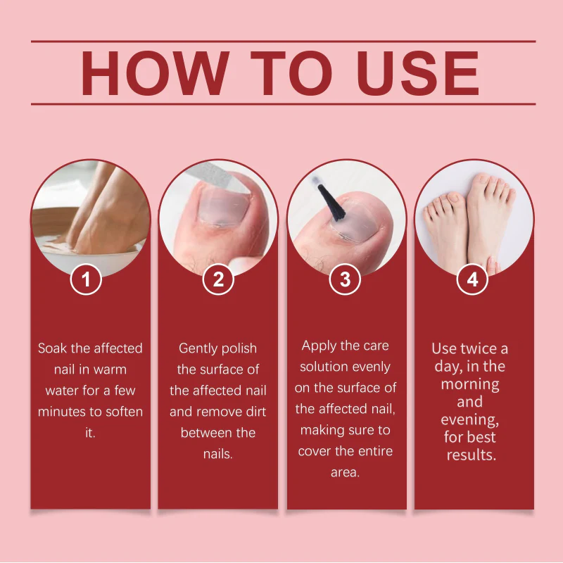 🖤See Real Results Faster🖤Nail Repair Essence for Damaged Nails💅🏻 - Image 6