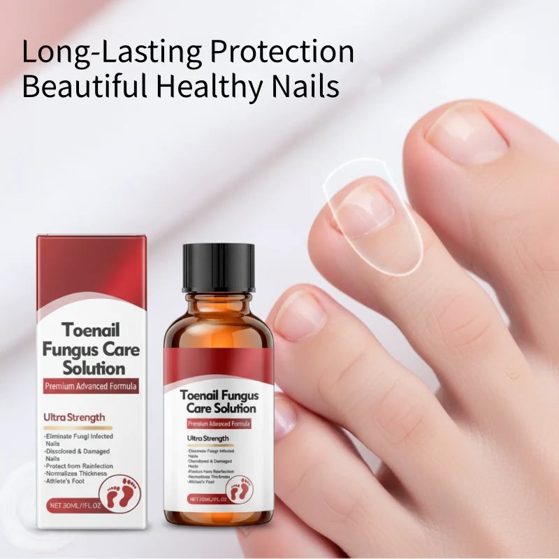 🖤See Real Results Faster🖤Nail Repair Essence for Damaged Nails💅🏻 - Image 7