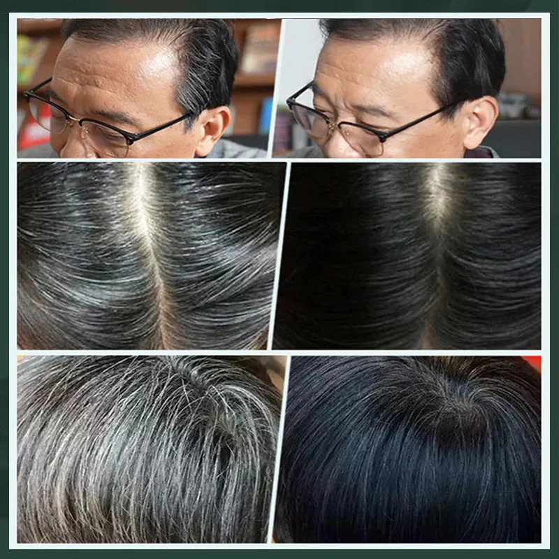 📢📢50% OFF !! ⏰Plant-Based Comb Hair Dye - Image 5