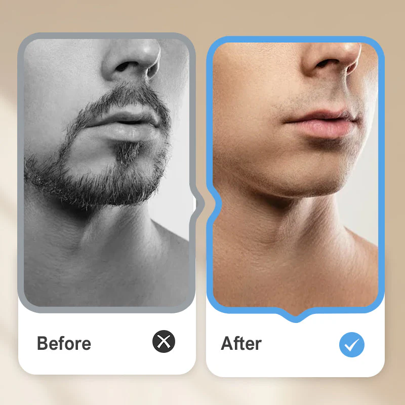 Portable Waterproof Electric Razor - Image 4
