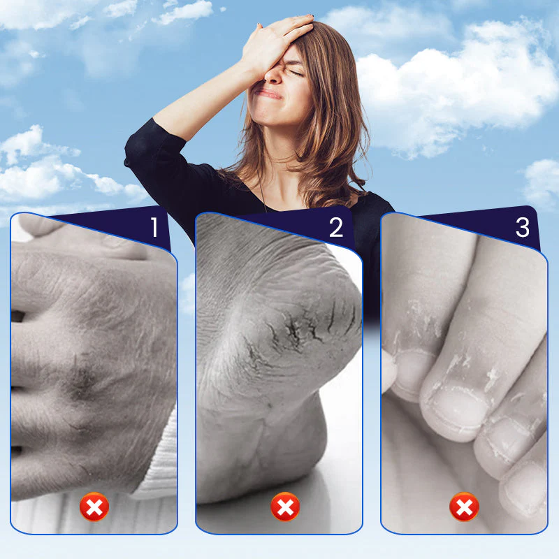 🩹 BUY 2 GET 1 FREE! ✨ Cracked Skin Repair Patch - Deep Hydration for Heels/Elbows, Pain Relief in 2 Hours, Invisible & Waterproof ⏳📦 - Image 2