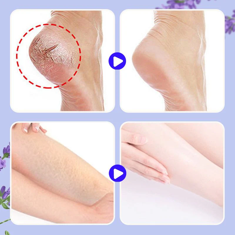 Anti-Crack Nourishing Foot Repair Balm - Image 4