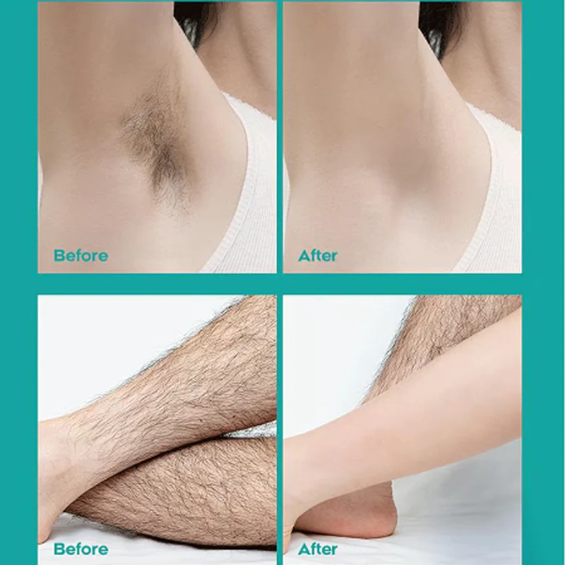 🔥Painless Full Body Hair Removal Cream for Men & Women– Skin-friendly for all areas🌿 - Image 4