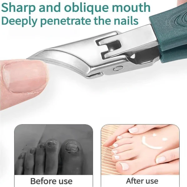 🔥Podiatrist-Recommended Nail Clippers - Ergonomic Angled Design for Toenails & Ingrowns - Limited 49% Deal